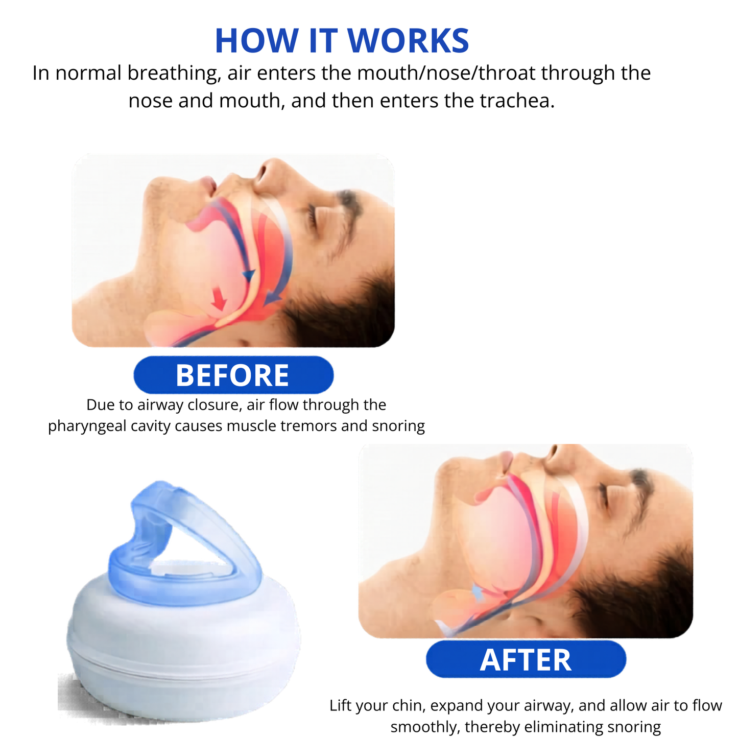 Silencr Pro Anti Snoring Mouthpiece